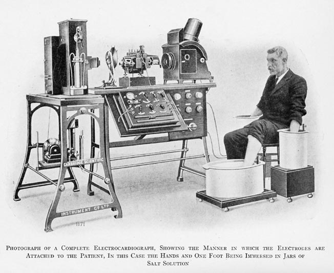 Electrocardiogram equipment has improved of late but it will never be as portable as an Apple Watch (Image Wiki Commons)